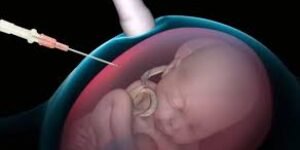 La Corte Suprema de México prohíbe el aborto que pretendía AMLO
