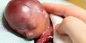 Francia da un paso más en el genocidio de los más indefensos: se podrá abortar hasta justo antes de que el niño nazca