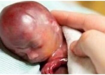 Francia da un paso más en el genocidio de los más indefensos: se podrá abortar hasta justo antes de que el niño nazca