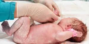 Atrocidad en Bélgica: el 94% de profesionales de la salud apoyan matar a recién nacidos con discapacidad