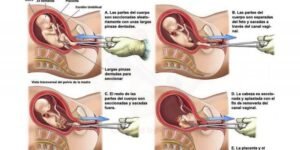 Aborto, el genocidio ocultado: en el año 2020, 1,8 millones de personas murieron por covid-19 frente a 42,6 millones de niños abortados en todo el mundo. ¿Y de qué hablan los medios? De la pandemia