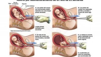 Aborto, el genocidio ocultado: en el año 2020, 1,8 millones de personas murieron por covid-19 frente a 42,6 millones de niños abortados en todo el mundo. ¿Y de qué hablan los medios? De la pandemia