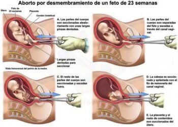 Aborto, el genocidio ocultado: en el año 2020, 1,8 millones de personas murieron por covid-19 frente a 42,6 millones de niños abortados en todo el mundo. ¿Y de qué hablan los medios? De la pandemia