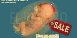 Colombia: se admite el comercio de órganos y tejidos de niños abortados