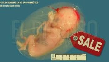 Colombia: se admite el comercio de órganos y tejidos de niños abortados