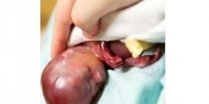 Crece la corriente provida en EEUU: un 52% de los estadounidenses consideran que el aborto debería estar prohibido