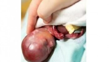 Crece la corriente provida en EEUU: un 52% de los estadounidenses consideran que el aborto debería estar prohibido