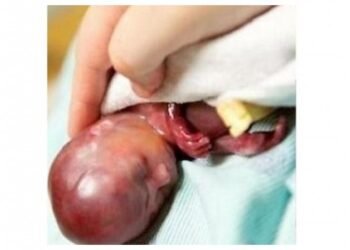 Crece la corriente provida en EEUU: un 52% de los estadounidenses consideran que el aborto debería estar prohibido