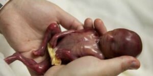 Durante 2021, 43 millones de niños fueron asesinados en el seno materno