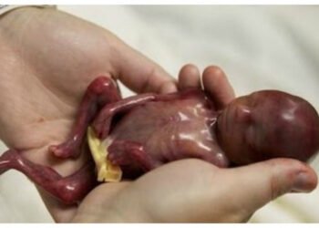 Durante 2021, 43 millones de niños fueron asesinados en el seno materno