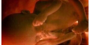 Colombia: la Corte Constitucional, con tufo NOM, despenaliza el aborto hasta los 6 meses para para “el ejercicio de los derechos sexuales y reproductivos”