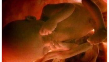 Colombia: la Corte Constitucional, con tufo NOM, despenaliza el aborto hasta los 6 meses para para “el ejercicio de los derechos sexuales y reproductivos”