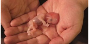 Importante victoria de la vida en EEUU. El Senado frena un proyecto de ley que habría permitido el aborto en cualquier etapa del embarazo y penaba la objeción de conciencia