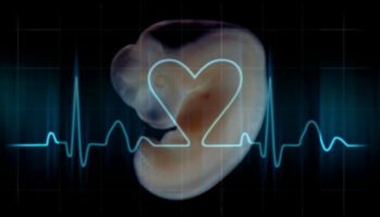 Un éxito provida. La Corte Suprema de Texas refrenda la ley del ‘latido del corazón’, que ya ha salvado a más de 20.000 niños
