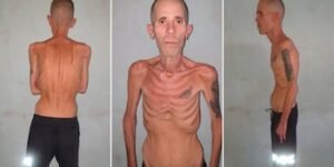 Las impactantes imágenes de un preso político cubano al salir de prisión luego de cinco años tras las rejas