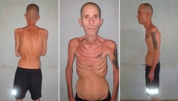 Las impactantes imágenes de un preso político cubano al salir de prisión luego de cinco años tras las rejas