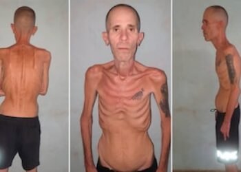 Las impactantes imágenes de un preso político cubano al salir de prisión luego de cinco años tras las rejas