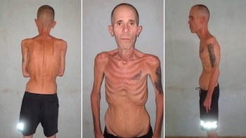 Alexander Díaz Rodríguez, un hombre calvo y demacrado, visto de frente, espalda y perfil. Sus huesos son muy prominentes y tiene tatuajes en los brazos